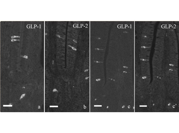 Immunofluorescence results with Donkey Anti-Rabbit IgG Rhodamine